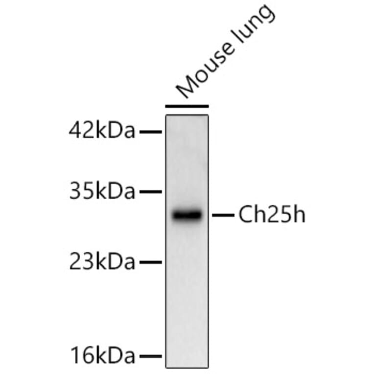 Western Blot - Anti-CH25H Antibody (A329254) - Antibodies.com