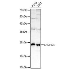 Western Blot - Anti-CHCHD4 Antibody (A329255) - Antibodies.com