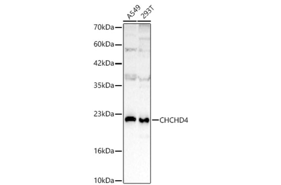 Western Blot - Anti-CHCHD4 Antibody (A329255) - Antibodies.com