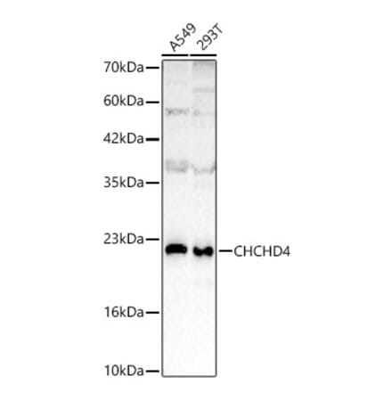 Western Blot - Anti-CHCHD4 Antibody (A329255) - Antibodies.com