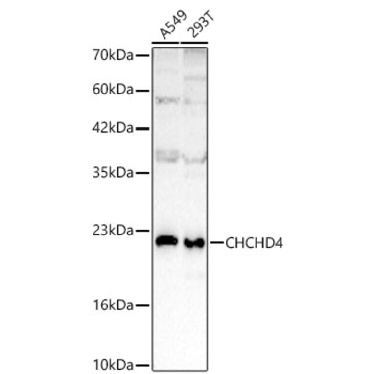 Western Blot - Anti-CHCHD4 Antibody (A329255) - Antibodies.com