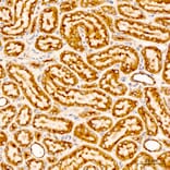 Immunohistochemistry - Anti-CHCHD4 Antibody (A329255) - Antibodies.com