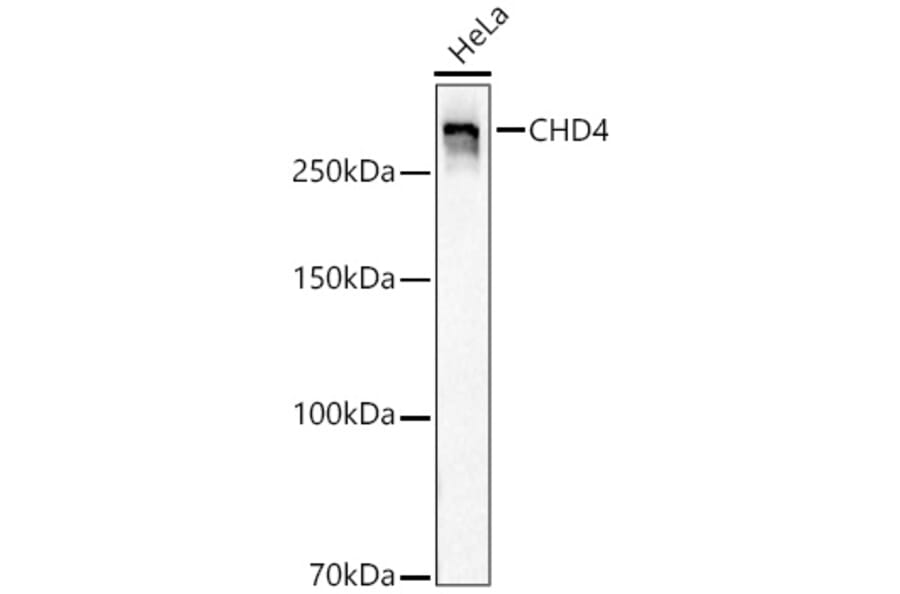 Western Blot - Anti-CHD4 Antibody [ARC59887] (A329256) - Antibodies.com