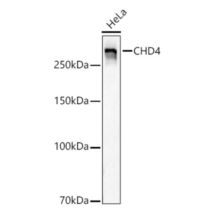 Western Blot - Anti-CHD4 Antibody [ARC59887] (A329256) - Antibodies.com