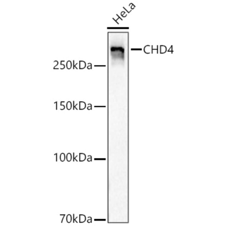 Western Blot - Anti-CHD4 Antibody [ARC59887] (A329256) - Antibodies.com