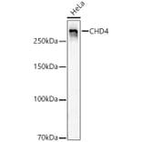 Western Blot - Anti-CHD4 Antibody [ARC59887] (A329256) - Antibodies.com