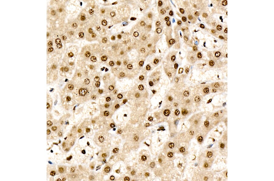 Immunohistochemistry - Anti-CHD4 Antibody [ARC59887] (A329256) - Antibodies.com
