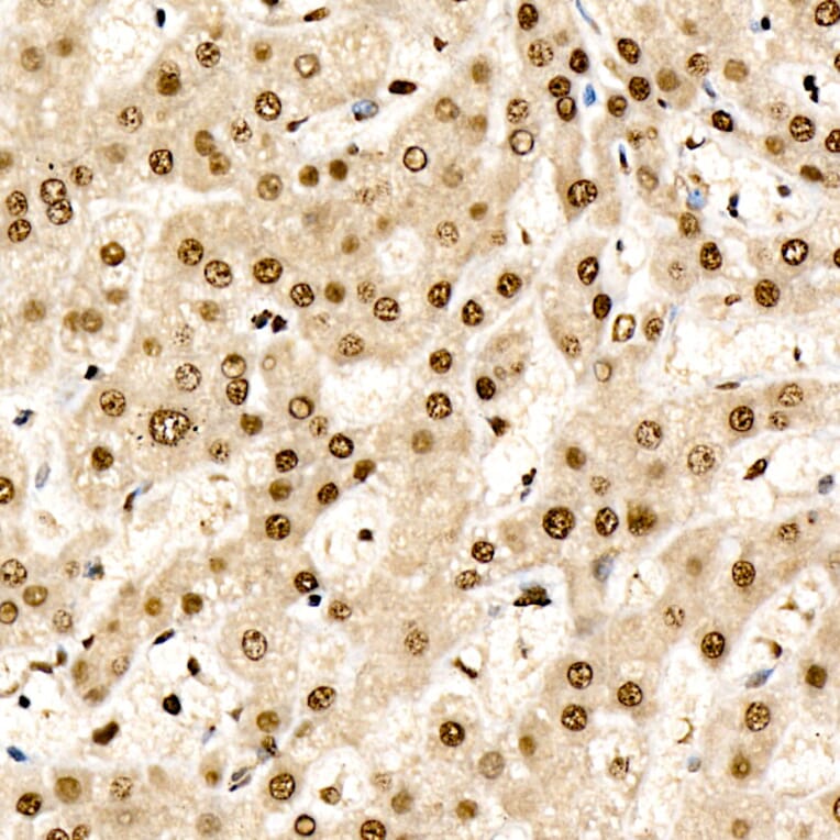 Immunohistochemistry - Anti-CHD4 Antibody [ARC59887] (A329256) - Antibodies.com
