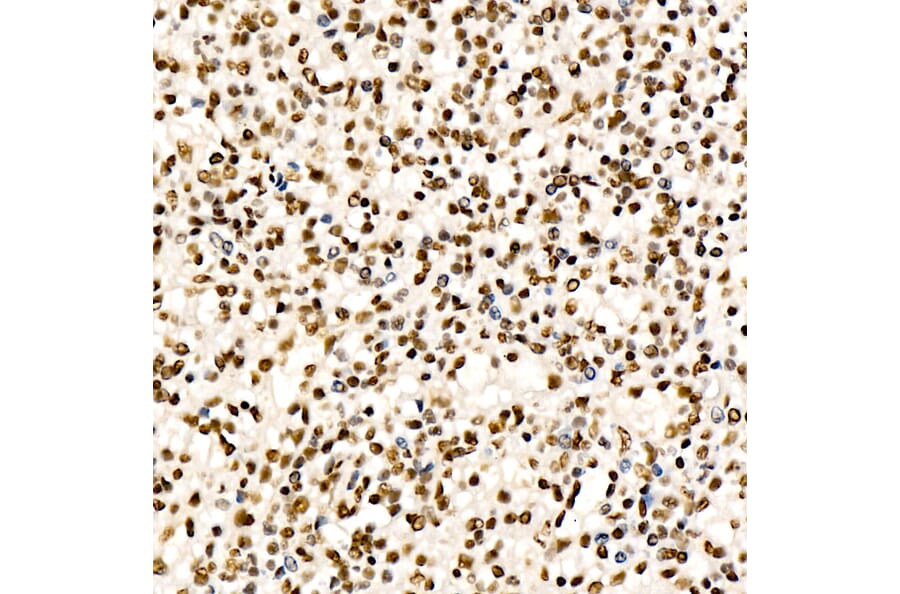 Immunohistochemistry - Anti-CHD4 Antibody [ARC59887] (A329256) - Antibodies.com