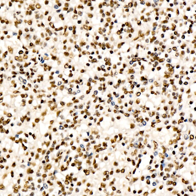 Immunohistochemistry - Anti-CHD4 Antibody [ARC59887] (A329256) - Antibodies.com