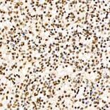 Immunohistochemistry - Anti-CHD4 Antibody [ARC59887] (A329256) - Antibodies.com