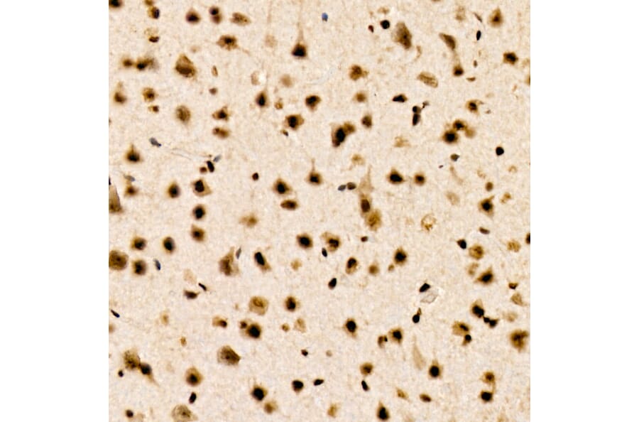 Immunohistochemistry - Anti-CHD4 Antibody [ARC59887] (A329256) - Antibodies.com
