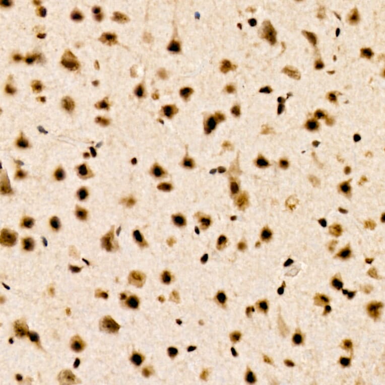 Immunohistochemistry - Anti-CHD4 Antibody [ARC59887] (A329256) - Antibodies.com
