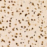 Immunohistochemistry - Anti-CHD4 Antibody [ARC59887] (A329256) - Antibodies.com