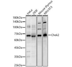 Western Blot - Anti-Chek2 Antibody (A329257) - Antibodies.com