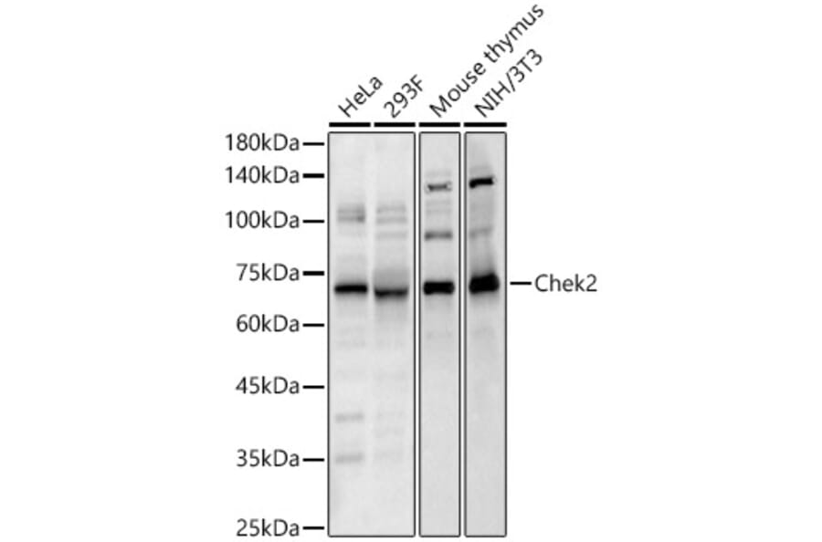 Western Blot - Anti-Chek2 Antibody (A329257) - Antibodies.com