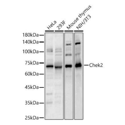 Western Blot - Anti-Chek2 Antibody (A329257) - Antibodies.com