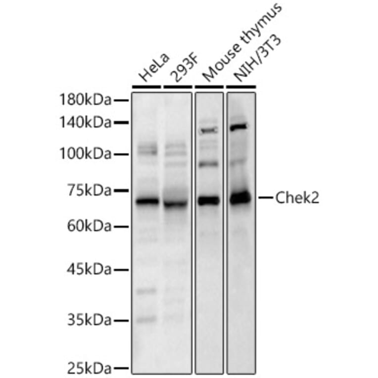 Western Blot - Anti-Chek2 Antibody (A329257) - Antibodies.com