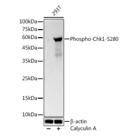 Western Blot - Anti-Chk1 (Phospho S280) Antibody [ARC3123] (A329261) - Antibodies.com