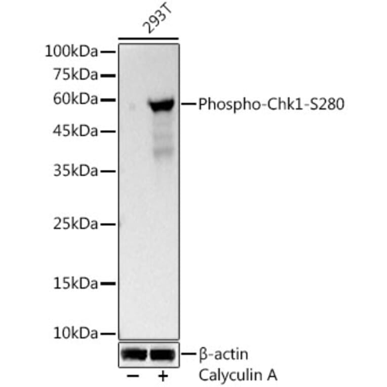 Western Blot - Anti-Chk1 (Phospho S280) Antibody [ARC3123] (A329261) - Antibodies.com