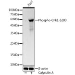 Western Blot - Anti-Chk1 (Phospho S280) Antibody [ARC3123] (A329261) - Antibodies.com