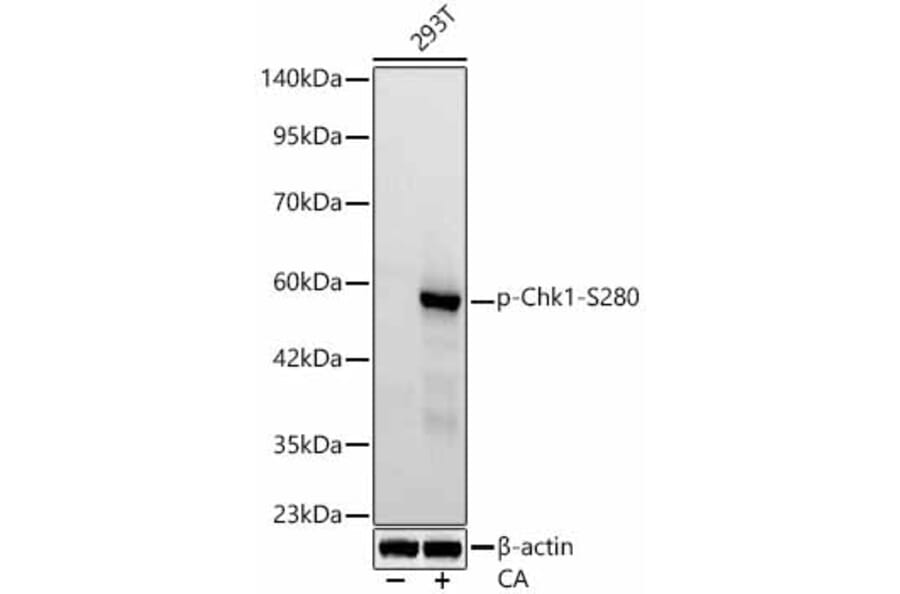Western Blot - Anti-Chk1 (Phospho S280) Antibody [ARC62579] (A329262) - Antibodies.com