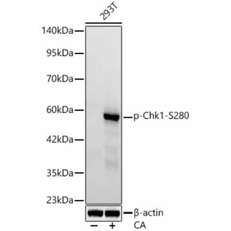 Western Blot - Anti-Chk1 (Phospho S280) Antibody [ARC62579] (A329262) - Antibodies.com