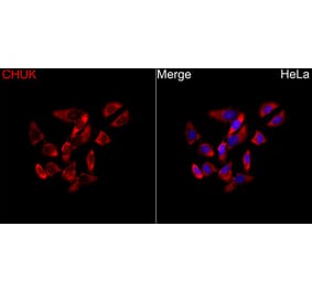 Immunofluorescence - Anti-CHUK Antibody (A329263) - Antibodies.com