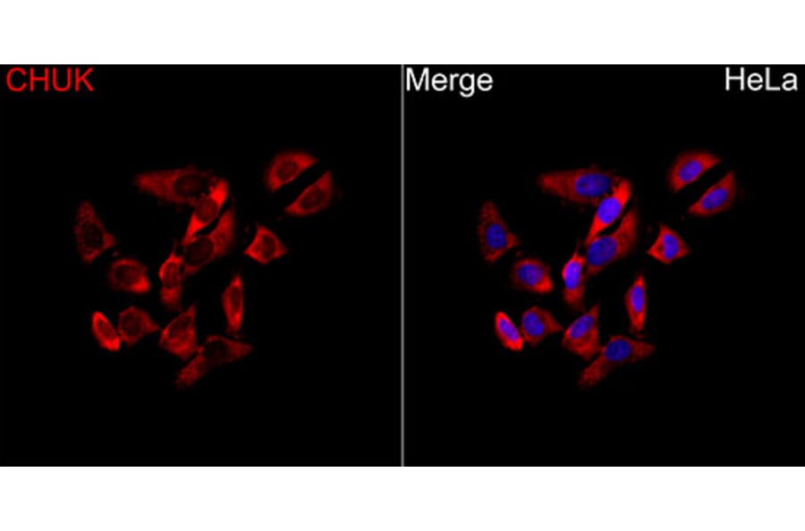 Immunofluorescence - Anti-CHUK Antibody (A329263) - Antibodies.com