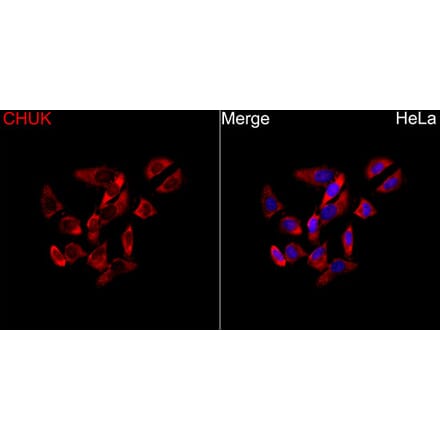 Immunofluorescence - Anti-CHUK Antibody (A329263) - Antibodies.com