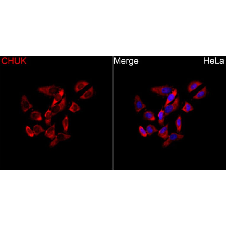 Immunofluorescence - Anti-CHUK Antibody (A329263) - Antibodies.com
