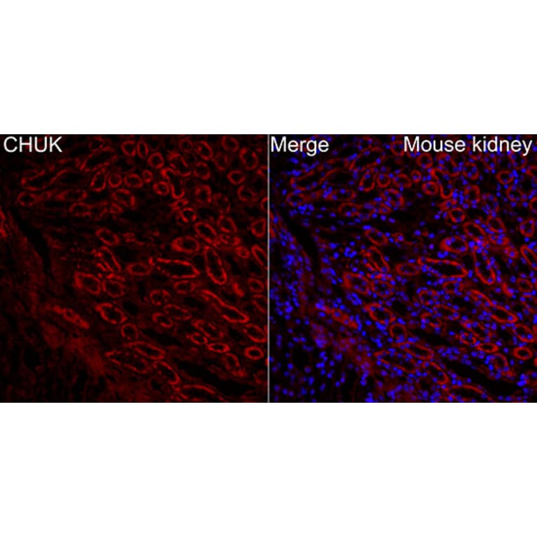Immunofluorescence - Anti-CHUK Antibody (A329263) - Antibodies.com
