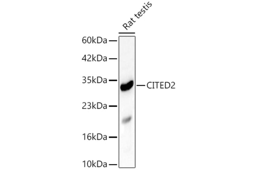 Western Blot - Anti-CITED2 Antibody (A329264) - Antibodies.com