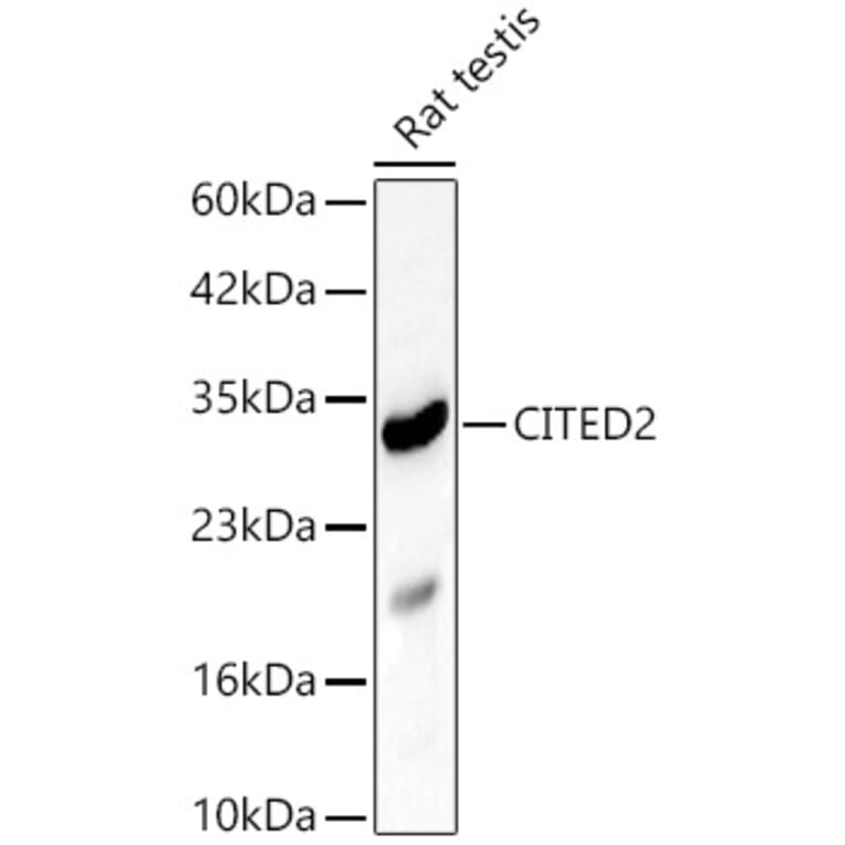Western Blot - Anti-CITED2 Antibody (A329264) - Antibodies.com