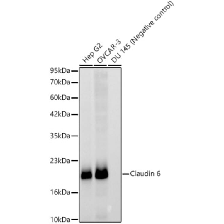 Western Blot - Anti-Claudin 6 Antibody [ARC63026] (A329265) - Antibodies.com