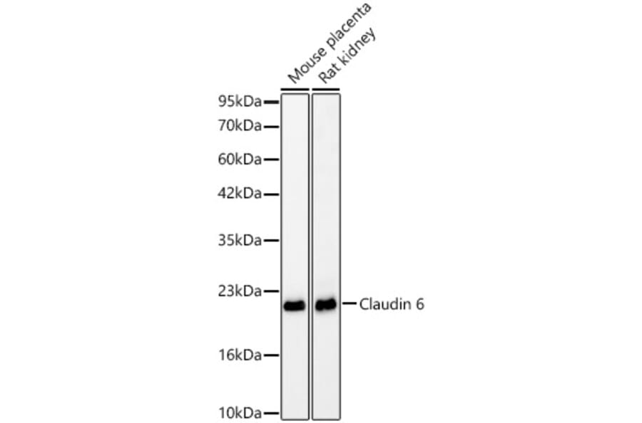Western Blot - Anti-Claudin 6 Antibody [ARC63026] (A329265) - Antibodies.com