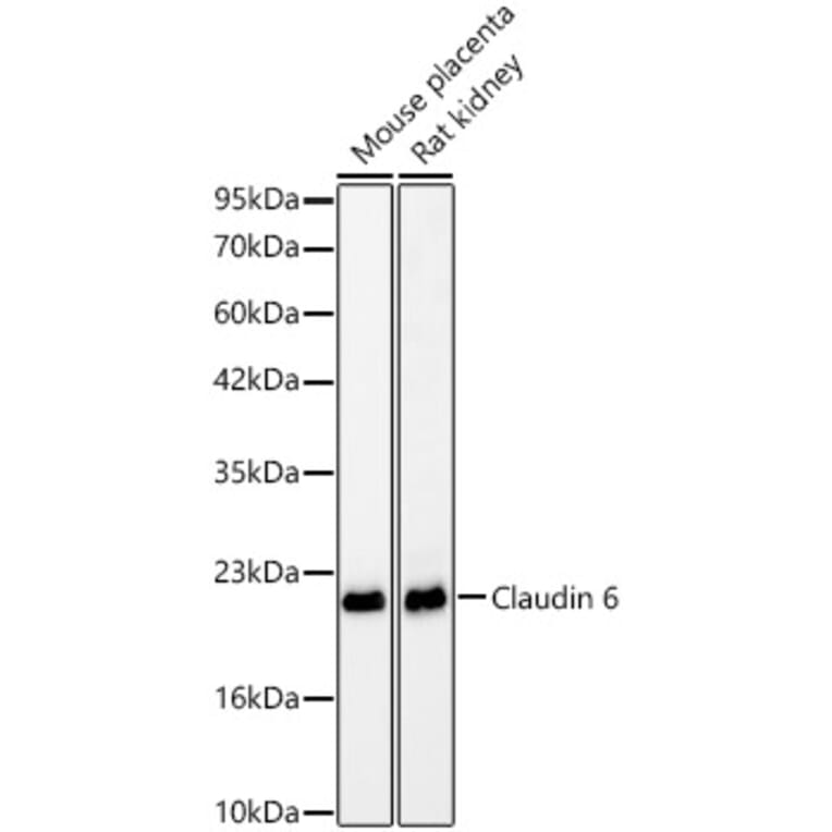 Western Blot - Anti-Claudin 6 Antibody [ARC63026] (A329265) - Antibodies.com