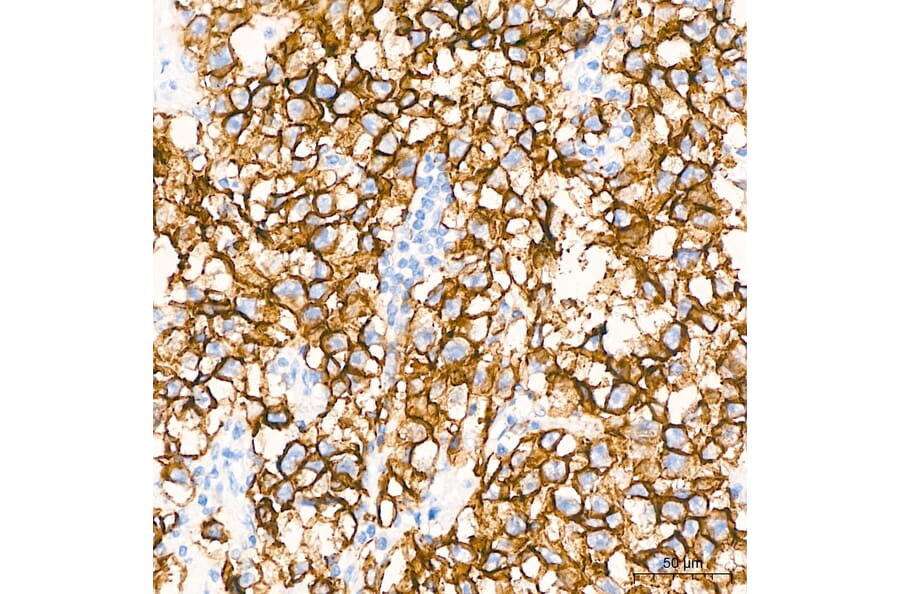 Immunohistochemistry - Anti-Claudin 6 Antibody [ARC63026] (A329265) - Antibodies.com