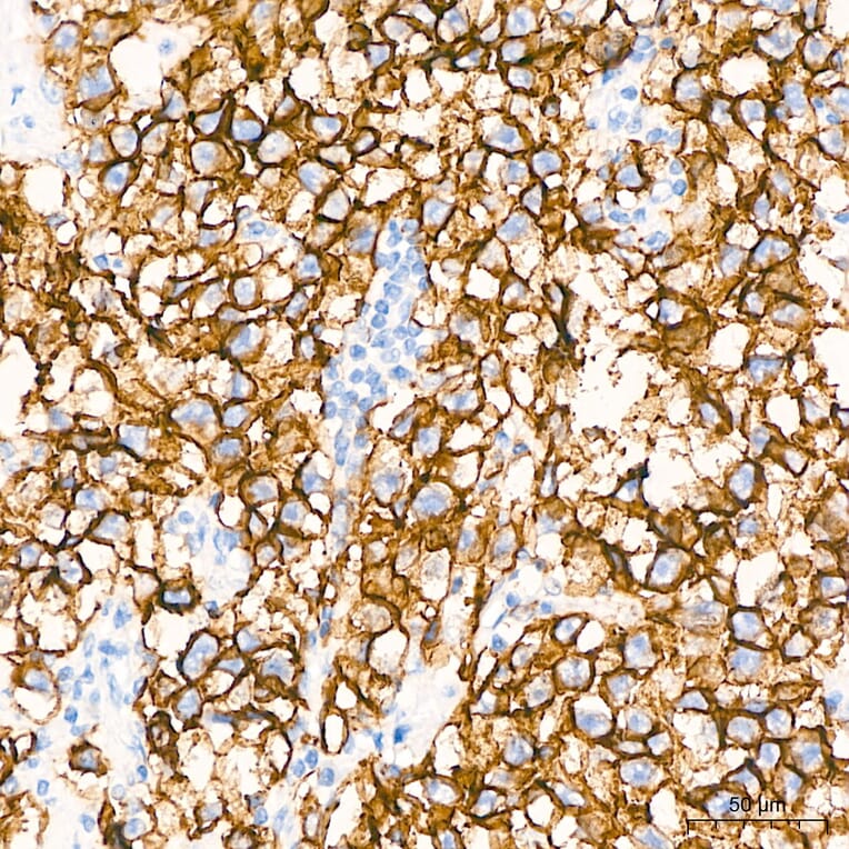 Immunohistochemistry - Anti-Claudin 6 Antibody [ARC63026] (A329265) - Antibodies.com