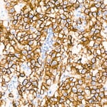 Immunohistochemistry - Anti-Claudin 6 Antibody [ARC63026] (A329265) - Antibodies.com