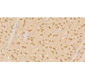 Immunohistochemistry - Anti-CLPB Antibody (A329268) - Antibodies.com