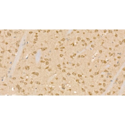 Immunohistochemistry - Anti-CLPB Antibody (A329268) - Antibodies.com