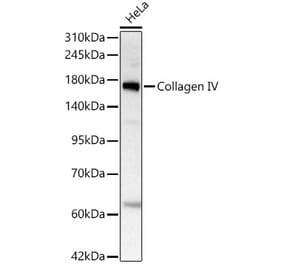 Western Blot - Anti-COL4A2 Antibody [ARC62585] (A329271) - Antibodies.com