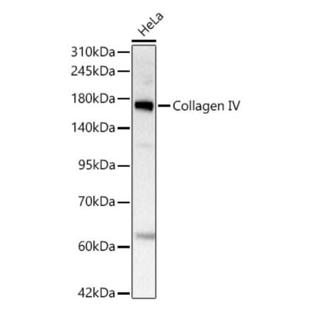 Western Blot - Anti-COL4A2 Antibody [ARC62585] (A329271) - Antibodies.com