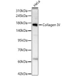 Western Blot - Anti-COL4A2 Antibody [ARC62585] (A329271) - Antibodies.com