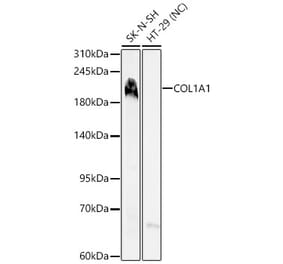 Western Blot - Anti-Collagen I Antibody (A329272) - Antibodies.com