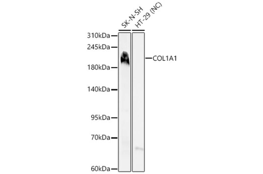 Western Blot - Anti-Collagen I Antibody (A329272) - Antibodies.com