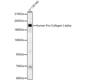 Western Blot - Anti-Collagen I Antibody (A329273) - Antibodies.com