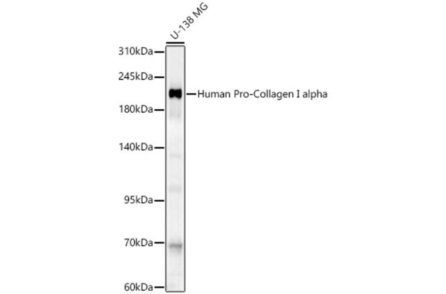 Western Blot - Anti-Collagen I Antibody (A329273) - Antibodies.com