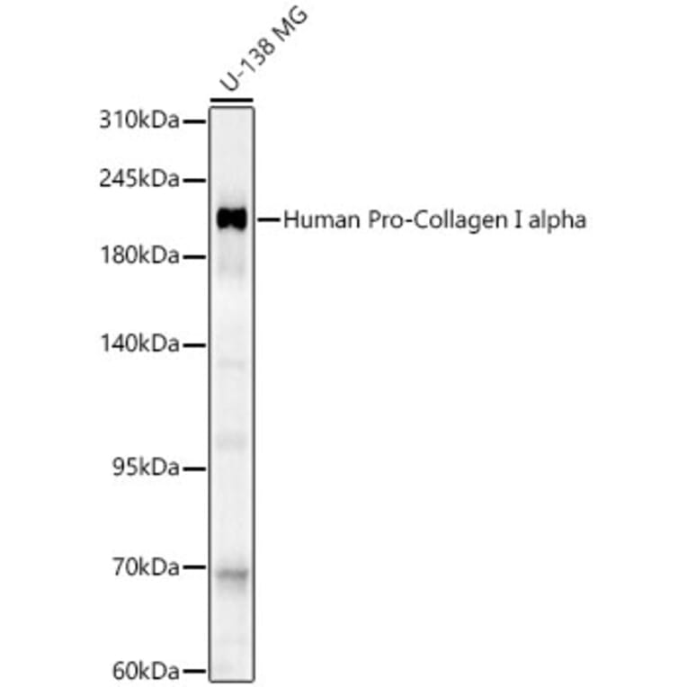 Western Blot - Anti-Collagen I Antibody (A329273) - Antibodies.com